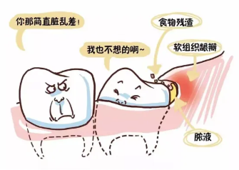 全国爱牙日——关于智齿那些事，你都知道多少？