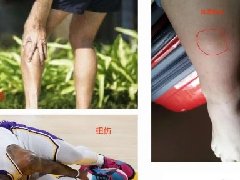 【科普】肌肉关节痛怎么办?肌骨超声精准找病因！
