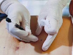 传承中华智慧，展现代医学魅力——中医适宜技术在妇产科诊治中的运用