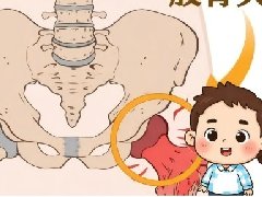【健康科普】股骨头坏死：别让“沉默的骨骼杀手”悄悄偷走行动力