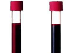 【健康科普】动脉血与静脉血：谁是血液界的“卷王”？