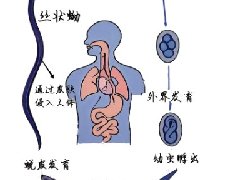 【健康科普】钩虫:躲在身体里面的吸血鬼